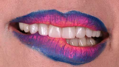 Keramik-Veneers und ästhetische Zahnversorgung in der Zahnarztpraxis Jakolitsch nahe Salzburg